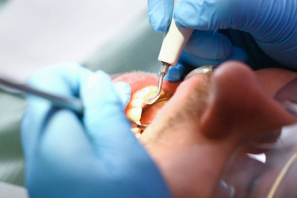 Best Pediatric Emergency Dentist in Ashland, AL