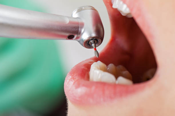 Best Emergency Broken Tooth Repair in Ashland, AL